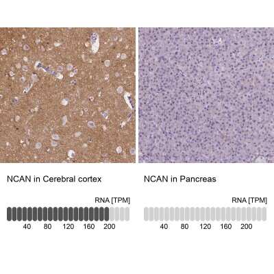 Immunohistochemistry-Paraffin: Neurocan Antibody [NBP1-84368]