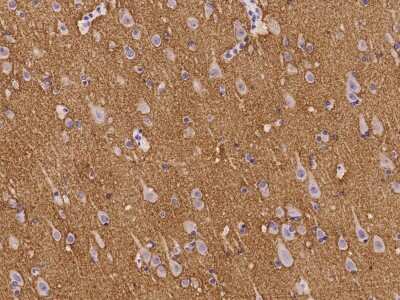Immunohistochemistry-Paraffin: Neurocan Antibody [NBP2-98027]