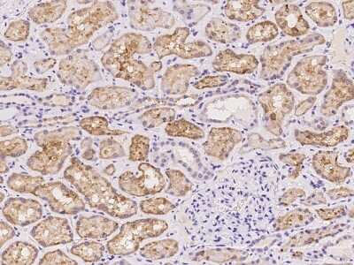 Immunohistochemistry-Paraffin: Neurocan Antibody [NBP2-98027]