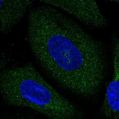 Immunocytochemistry/ Immunofluorescence: Neurochondrin Antibody [NBP1-87901]