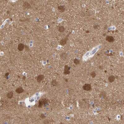 Immunohistochemistry-Paraffin: Neurochondrin Antibody [NBP1-87901]
