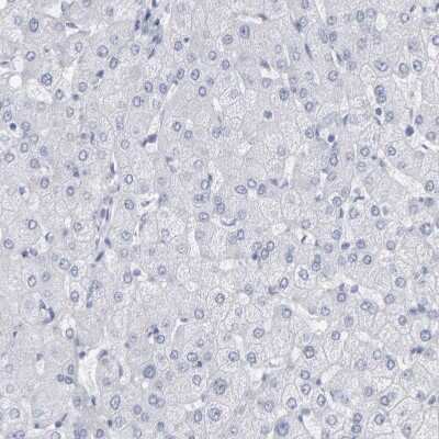 Immunohistochemistry-Paraffin: Neurochondrin Antibody [NBP1-87901]