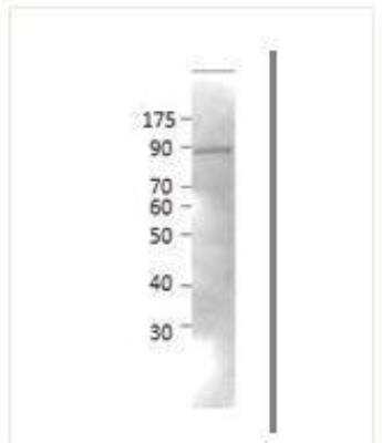 Western Blot: Neurochondrin Antibody [NBP1-60892]