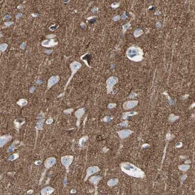 Immunohistochemistry-Paraffin: Neurofascin Antibody [NBP1-81886]