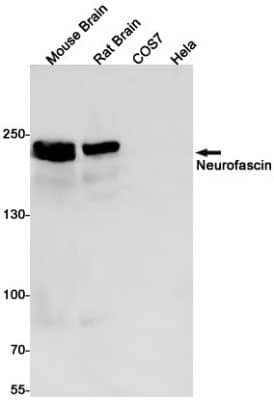 Western Blot: Neurofascin Antibody (S07-0B3) [NBP3-19519]