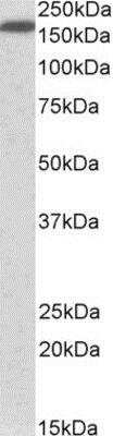 Western Blot: Neurofascin Antibody [NBP1-78794]