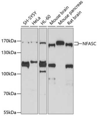 Western Blot: Neurofascin AntibodyBSA Free [NBP2-95191]