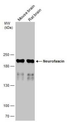 Western Blot: Neurofascin Antibody [NBP3-13182]