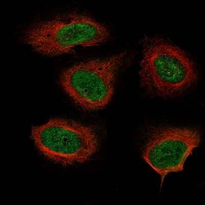 Immunocytochemistry/ Immunofluorescence: Neurofibromin 1 Antibody (CL11865) [NBP3-15123]