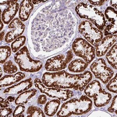 Immunohistochemistry-Paraffin: Neurofibromin 1 Antibody [NBP2-37914]