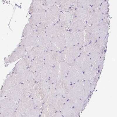 Immunohistochemistry-Paraffin: Neurofibromin 1 Antibody [NBP2-37914]