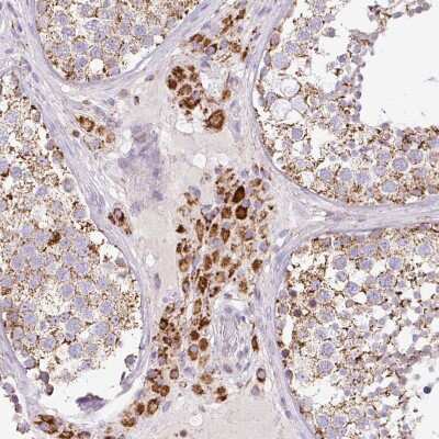 Immunohistochemistry-Paraffin: Neurofibromin 1 Antibody [NBP2-37914]