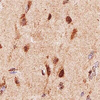 Immunocytochemistry: Neurofibromin 1 Antibody (McNFn27a) - Azide and BSA Free [NBP2-80870]