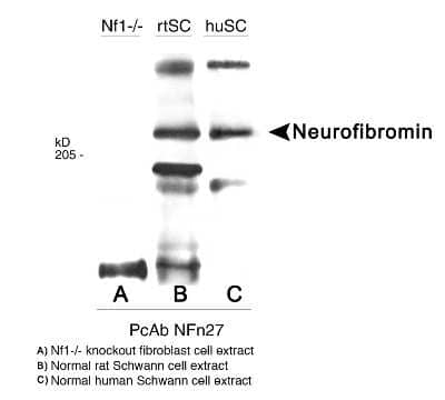 Western Blot: Neurofibromin 1 Antibody [NB300-155]