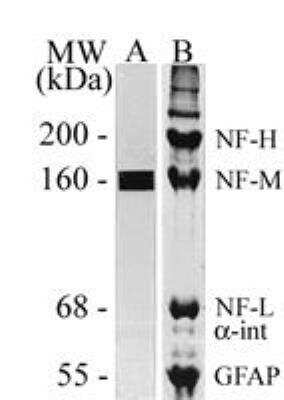 Western Blot: NF-M Antibody (MCA-3H11) [NBP2-31206]