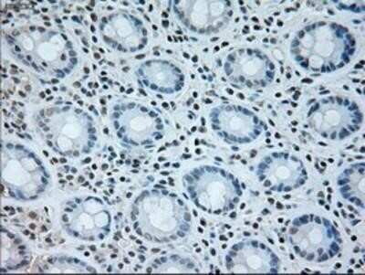 Immunohistochemistry: Neurogenin-1 Antibody (OTI3F9) - Azide and BSA Free [NBP2-72948]