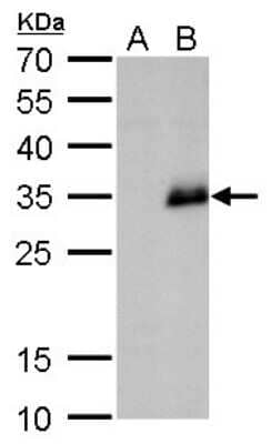 Western Blot: Neurogenin-1 Antibody [NBP2-43749]