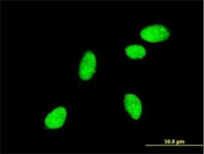 Immunocytochemistry/ Immunofluorescence: Neurogenin-2 Antibody (1B2) [H00063973-M01]