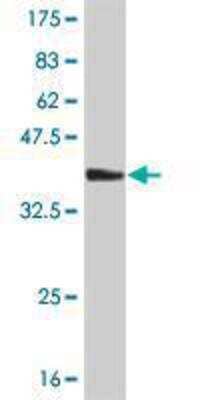 Western Blot: Neurogenin-2 Antibody (1G8) [H00063973-M03]