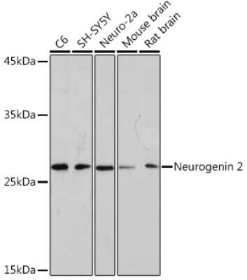 Western Blot: Neurogenin-2 Antibody (8F2Q8) [NBP3-15924]