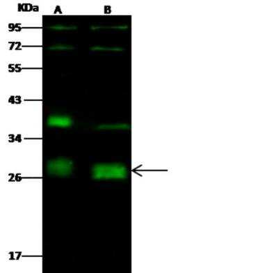 Western Blot: Neurogenin-2 Antibody [NBP2-98917]