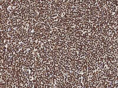 Immunohistochemistry-Paraffin: Neurogenin-3 Antibody [NBP2-98714]