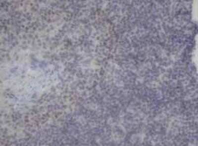 Immunohistochemistry: Neurogenin-3 Antibody (OTI3B5) - Azide and BSA Free [NBP2-72956]