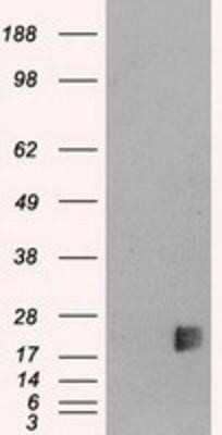 Western Blot: Neurogenin-3 Antibody (OTI3B5) [NBP1-47878]