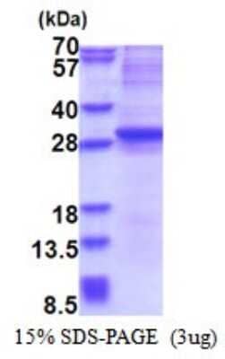 SDS-PAGE: Recombinant Human Neurogenin-3 His Protein [NBP2-51514]