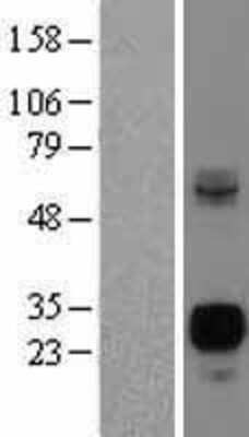 Western Blot: Neurogenin-3 Overexpression Lysate [NBL1-13604]