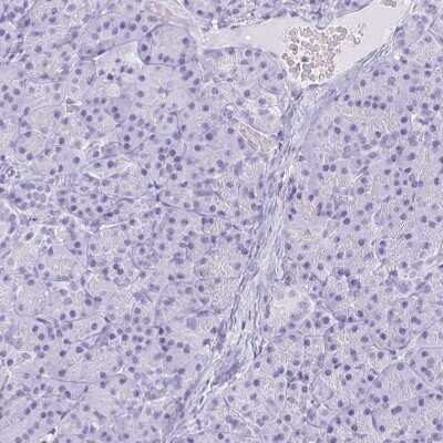 Immunohistochemistry-Paraffin: Neuroglobin Antibody [NBP2-49287]