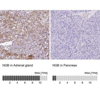 Immunohistochemistry-Paraffin: Neuroglobin Antibody [NBP2-49287]