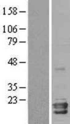 Western Blot: Neuroglobin Overexpression Lysate [NBL1-13631]