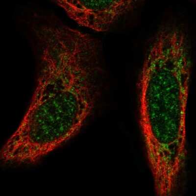 Immunocytochemistry/ Immunofluorescence: Neuroglycan C/CSPG5 Antibody [NBP2-56381]