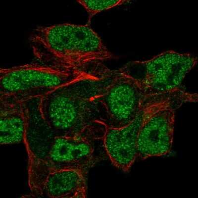 Immunocytochemistry/ Immunofluorescence: Neuroglycan C/CSPG5 Antibody [NBP2-58590]