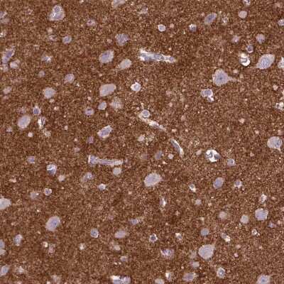 Immunohistochemistry-Paraffin: Neuroglycan C/CSPG5 Antibody [NBP2-49669]