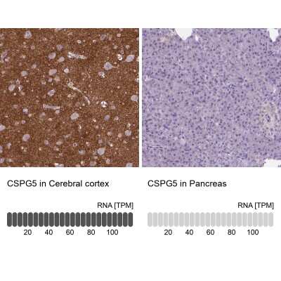 Immunohistochemistry-Paraffin: Neuroglycan C/CSPG5 Antibody [NBP2-49669]