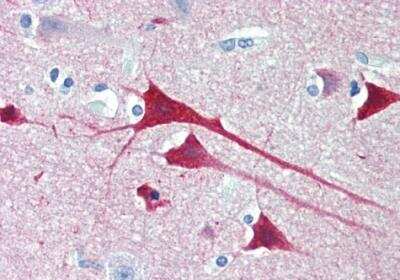 Immunohistochemistry-Paraffin: Neurogranin Antibody [NBP2-29349]