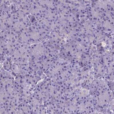 Immunohistochemistry-Paraffin: Neurogranin Antibody [NBP2-32655]