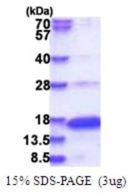 SDS-PAGE: Recombinant Human Neurogranin His Protein [NBP2-51746]