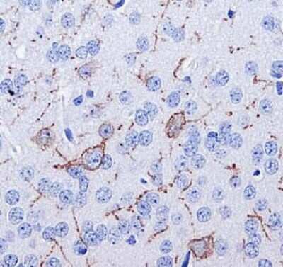 Immunohistochemistry: NK1R Antibody [NB300-101]