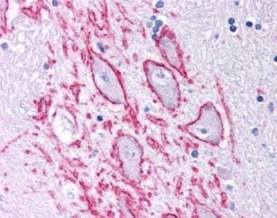 Immunohistochemistry: NK1R Antibody Pack [NB100-912]