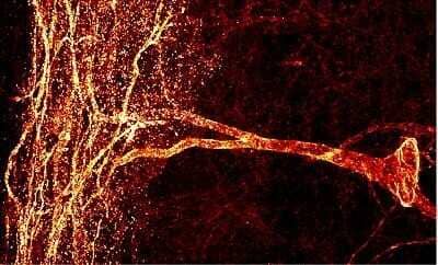 Immunohistochemistry: NK1R Antibody Pack [NB100-912]