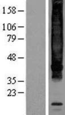 Western Blot: NK1R Overexpression Lysate [NBL1-16672]