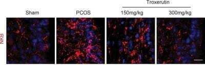 Immunohistochemistry: Neurokinin B Antibody - BSA Free [NB300-201]