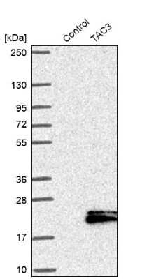 Western Blot: Neurokinin B Antibody [NBP1-92178]