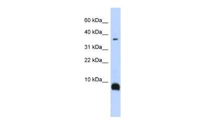 Western Blot: Neurokinin B Antibody [NBP2-85377]