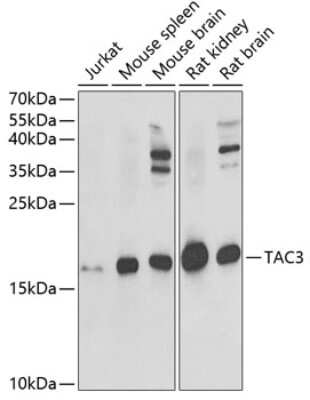 Western Blot: Neurokinin B AntibodyBSA Free [NBP2-93826]