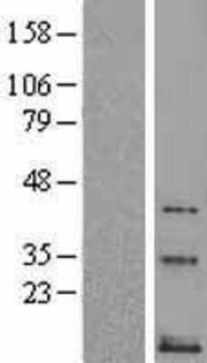 Western Blot: Neurokinin B Overexpression Lysate [NBL1-16669]