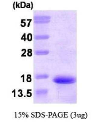 SDS-PAGE: Recombinant Human Neurokinin B His Protein [NBP1-30196]